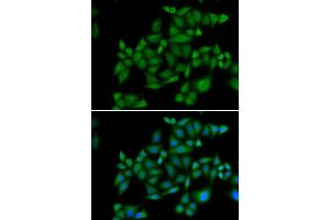 Immunofluorescence analysis of HeLa cell using BLZF1 antibody. (BLZF1 antibody)
