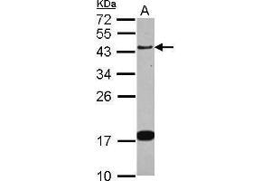WB Image Sample (30 ug of whole cell lysate) A: IMR32 12% SDS PAGE antibody diluted at 1:1000 (GAP43 antibody)