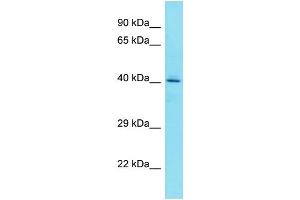 Host: Rabbit Target Name: FAM203A Sample Type: HepG2 Whole Cell lysates Antibody Dilution: 1. (FAM203B antibody  (C-Term))