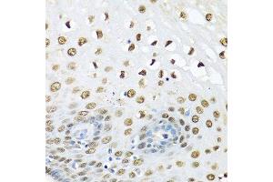 Immunohistochemistry (Paraffin-embedded Sections) (IHC (p)) image for anti-Ubiquitin C (UBC) (AA 1-100) antibody (ABIN1683190)