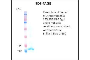 SDS-PAGE (SDS) image for Melanoma Inhibitory Activity (MIA) (Active) protein (ABIN5509521) (MIA Protein)