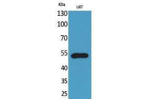 Western Blotting (WB) image for anti-Chemokine (C-X3-C Motif) Receptor 1 (CX3CR1) (Internal Region) antibody (ABIN3178143) (CX3CR1 antibody  (Internal Region))