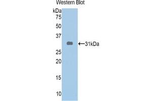 Detection of Recombinant ABCA1, Human using Polyclonal Antibody to ATP Binding Cassette Transporter A1 (ABCA1) (ABCA1 antibody  (AA 1404-1663))