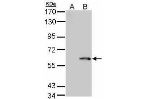 WB Image Western Blot analysis of FPGS expression in transfected 293T cell line by FPGS polyclonal antibody. (FPGS antibody)