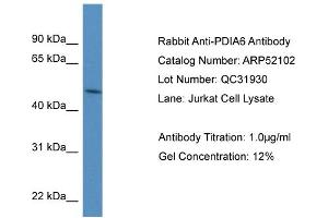 WB Suggested Anti-PDIA6 Antibody Titration: 0. (PDIA6 antibody  (N-Term))