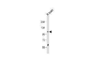 Anti-DSTYK Antibody (N-Term)at 1:2000 dilution + rat brain lysate Lysates/proteins at 20 μg per lane. (DSTYK antibody  (AA 256-290))