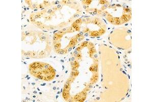 Immunohistochemistry of paraffin embedded human kidney using CYP20A1 (ABIN7073675) at dilution of 1: 700 (400x lens) (CYP20A1 antibody)