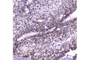 IHC analysis of CLPP using anti-CLPP antibody . (CLPP antibody  (AA 184-247))