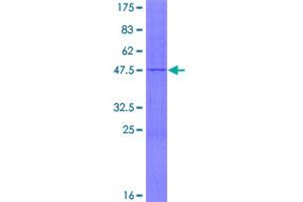 MRPL17 Protein (AA 1-175) (GST tag)