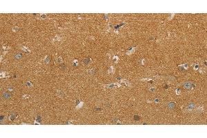 Immunohistochemistry of paraffin-embedded Human brain using GJB6 Polyclonal Antibody at dilution of 1:30 (GJB6 antibody)