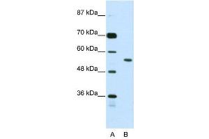 WB Suggested Anti-BRD3  Antibody Titration: 2. (BRD3 antibody  (N-Term))