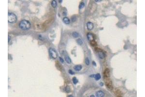 Immunohistochemistry (IHC) image for anti-Apolipoprotein L, 2 (APOL2) (AA 186-337) antibody (ABIN7441058)