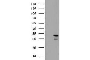 Western Blotting (WB) image for anti-RASD Family, Member 2 (RASD2) antibody (ABIN1500696)