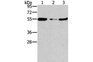 Western Blot analysis of Mouse heart tissue and NIH/3T3 cell, Mouse liver tissue using FGFR1OP Polyclonal Antibody at dilution of 1:850
