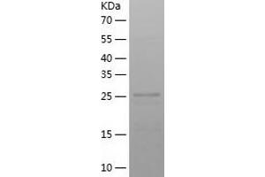 ADAMTS18 Protein (AA 712-970) (His tag)