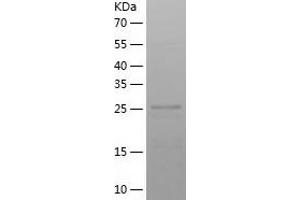 Western Blotting (WB) image for ADAM Metallopeptidase with thrombospondin Type 1 Motif, 18 (ADAMTS18) (AA 712-970) protein (His tag) (ABIN7121693) (ADAMTS18 Protein (AA 712-970) (His tag))