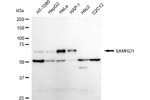 Western blotting analysis using SAMHD1 antibody (ABIN7800270).