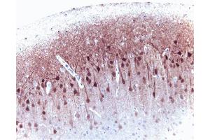 ERK 2 (clone 33) staining on rat brain. (ERK2 antibody  (AA 219-358))