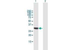 Western Blot analysis of RDH16 expression in transfected 293T cell line by RDH16 MaxPab polyclonal antibody. (RDH16 antibody  (AA 1-317))