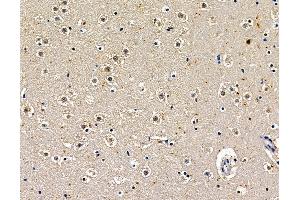 ABIN7097016 and ABIN7101083 at 1/100 staining mouse brain tissue by IHC-P. (POU6F2 antibody)