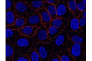 Immunofluorescence (IF) image for anti-AHNAK Nucleoprotein (AHNAK) (N-Term) antibody (ABIN263928) (AHNAK antibody  (N-Term))