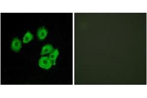 Immunofluorescence analysis of HuvEc cells, using CLTR1 Antibody. (CysLTR1 antibody  (AA 131-180))