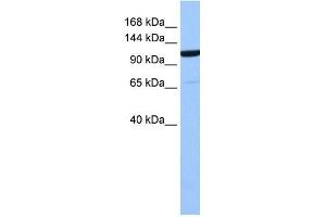 NUP155 antibody used at 1 ug/ml to detect target protein. (NUP155 antibody  (Middle Region))
