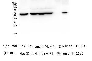 Western blot analysis of TCP1 alpha using anti-TCP1 alpha antibody . (TCP1 alpha/CCTA antibody  (C-Term))