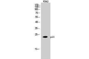 Western Blotting (WB) image for anti-Cyclin-Dependent Kinase 5, Regulatory Subunit 1 (p35) (CDK5R1) (Tyr579) antibody (ABIN3186243) (CDK5R1 antibody  (Tyr579))
