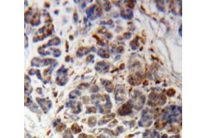 Used in DAB staining on fromalin fixed paraffin-embedded Pancreas tissue (PIK3C2A antibody  (AA 349-611))