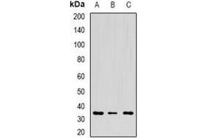 Western blot analysis of CD272 expression in mouse spleen (A), mouse thymus (B), rat lung (C) whole cell lysates.