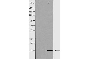 Western blot analysis of extracts of HeLa  using H3R8me2s antibody.