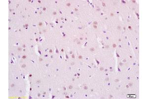 Formalin-fixed and paraffin embedded rat brain labeled with Anti-Phospho-SIRT1(Ser47) Polyclonal Antibody, Unconjugated (ABIN745658) at 1:200 followed by conjugation to the secondary antibody and DAB staining (SIRT1 antibody  (pSer47))