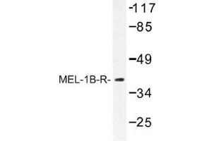 Image no. 1 for anti-Melatonin Receptor 1B (MTNR1B) antibody (ABIN317757) (Melatonin Receptor 1B antibody)