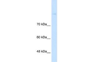 Host:  Rabbit  Target Name:  CDH8  Sample Type:  Jurkat  Antibody Dilution:  1. (Cadherin 8 antibody  (Middle Region))