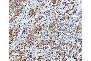 IHC analysis of Neurofibromin/NF1 using anti-Neurofibromin/NF1 antibody (ABIN7600196). (Neurofibromin 1 antibody  (AA 160-270))