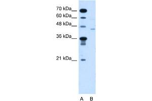 WB Suggested Anti-FKTN Antibody Titration:  5.