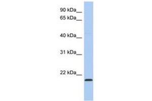 Image no. 1 for anti-RWD Domain Containing 4 (RWDD4) (C-Term) antibody (ABIN6743711)