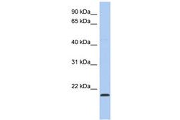 RWDD4A 抗体  (C-Term)