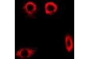 Immunofluorescent analysis of PYGL staining in MCF7 cells.