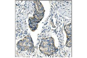 IHC analysis of ANGPT2 using anti-ANGPT2 antibody (ABIN7601450). (Angiopoietin 2 antibody  (AA 357-404))