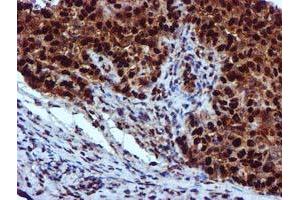 Image no. 5 for anti-EPM2A (Laforin) Interacting Protein 1 (EPM2AIP1) antibody (ABIN1498045) (EPM2AIP1 antibody)