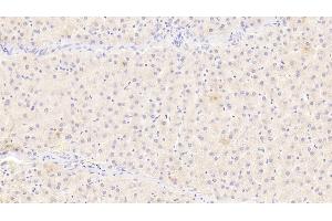 Detection of IL12B in Human Liver Tissue using Monoclonal Antibody to Interleukin 12B (IL12B) (IL12B antibody  (AA 30-320))
