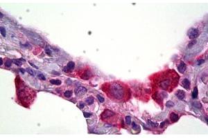Anti-HSD11B1 antibody IHC staining of human lung, macrophages. (HSD11B1 antibody)