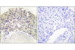 Immunohistochemistry (IHC) image for anti-SHC (Src Homology 2 Domain Containing) Transforming Protein 1 (SHC1) (AA 315-364), (pTyr349) antibody (ABIN1531193)