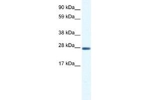 WB Suggested Anti-CLIC1 Antibody Titration:  0. (CLIC1 antibody  (C-Term))