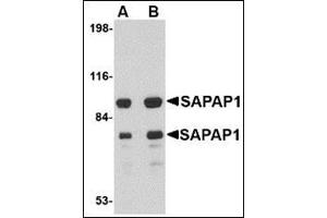 Western blot analysis of SAPAP1 in rat brain tissue lysate with this product at (A) 0. (DLGAP1 antibody  (Center))