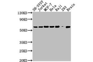 Western Blot Positive WB detected in: SH-SY5Y whole cell lysate, Jurkat whole cell lysate, MCF-7 whole cell lysate, Hela whole cell lysate, Raji whole cell lysate, 293 whole cell lysate, Mouse brain tissue All lanes: PKM antibody at 1:2000 Secondary Goat polyclonal to rabbit IgG at 1/50000 dilution Predicted band size: 58, 59, 57 kDa Observed band size: 58 kDa (Recombinant PKM antibody)