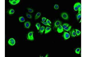 Immunofluorescent analysis of MCF-7 cells using ABIN7167443 at dilution of 1:100 and Alexa Fluor 488-congugated AffiniPure Goat Anti-Rabbit IgG(H+L) (REEP3 antibody  (AA 80-255))