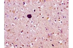 IHC image of ABIN7144809 diluted at 1:100 and staining in paraffin-embedded human brain tissue performed on a Leica BondTM system. (ATL1 antibody  (AA 220-350))